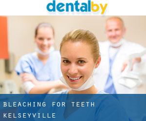 Bleaching for Teeth (Kelseyville)