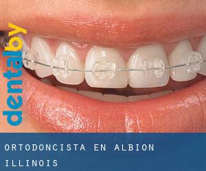 Ortodoncista en Albion (Illinois)
