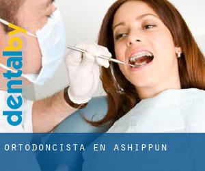 Ortodoncista en Ashippun