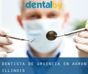 Dentista de urgencia en Akron (Illinois)