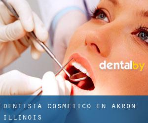 Dentista Cosmético en Akron (Illinois)