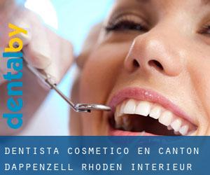Dentista Cosmético en Canton d'Appenzell Rhoden-Intérieur