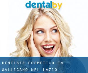 Dentista Cosmético en Gallicano nel Lazio