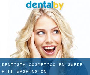 Dentista Cosmético en Swede Hill (Washington)