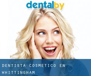 Dentista Cosmético en Whittingham
