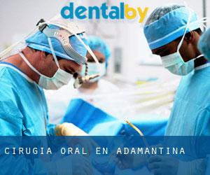 Cirugía Oral en Adamantina