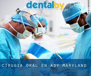Cirugía Oral en Ady (Maryland)