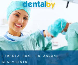 Cirugía Oral en Asnans-Beauvoisin