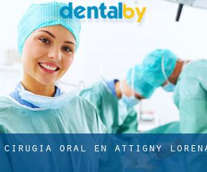 Cirugía Oral en Attigny (Lorena)