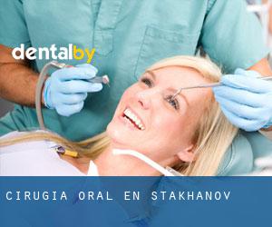 Cirugía Oral en Stakhanov