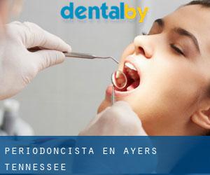 Periodoncista en Ayers (Tennessee)