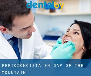 Periodoncista en Gap of the Mountain