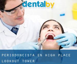 Periodoncista en High Place Lookout Tower