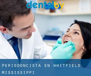 Periodoncista en Whitfield (Mississippi)