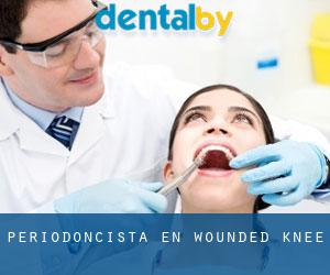 Periodoncista en Wounded Knee