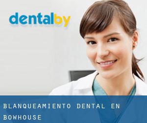 Blanqueamiento dental en Bowhouse