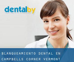 Blanqueamiento dental en Campbells Corner (Vermont)