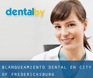 Blanqueamiento dental en City of Fredericksburg