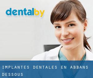 Implantes Dentales en Abbans-Dessous