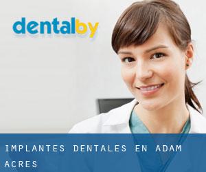 Implantes Dentales en Adam Acres