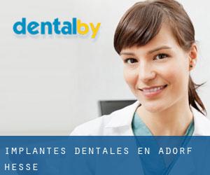 Implantes Dentales en Adorf (Hesse)