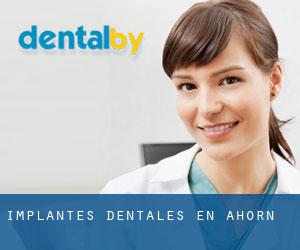 Implantes Dentales en Ahorn