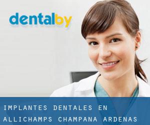 Implantes Dentales en Allichamps (Champaña-Ardenas)