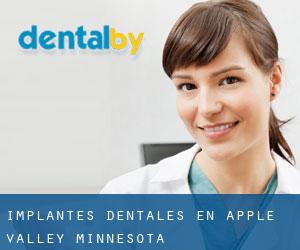 Implantes Dentales en Apple Valley (Minnesota)
