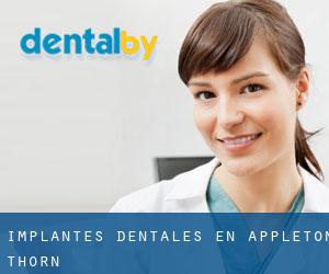 Implantes Dentales en Appleton Thorn