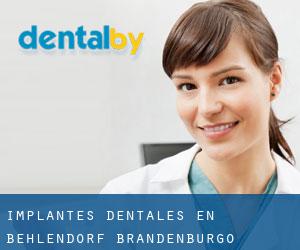 Implantes Dentales en Behlendorf (Brandenburgo)