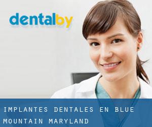 Implantes Dentales en Blue Mountain (Maryland)