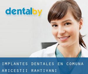 Implantes Dentales en Comuna Ariceştii-Rahtivani