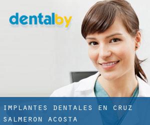 Implantes Dentales en Cruz Salmerón Acosta