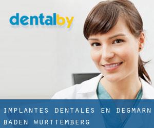 Implantes Dentales en Degmarn (Baden-Württemberg)