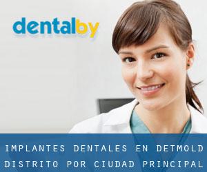 Implantes Dentales en Detmold Distrito por ciudad principal - página 1