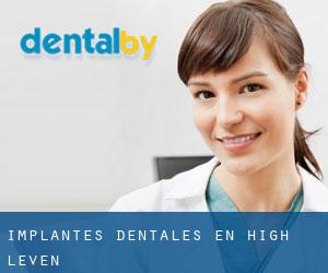 Implantes Dentales en High Leven