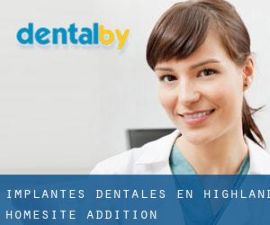 Implantes Dentales en Highland Homesite Addition
