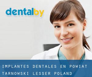 Implantes Dentales en Powiat tarnowski (Lesser Poland Voivodeship) (Pequeña Polonia)