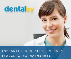 Implantes Dentales en Saint-Aignan (Alta Normandía)