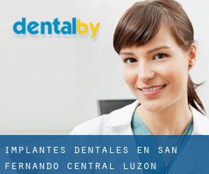 Implantes Dentales en San Fernando (Central Luzon)