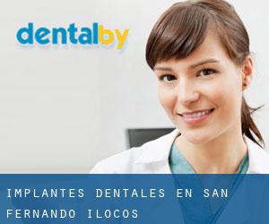 Implantes Dentales en San Fernando (Ilocos)