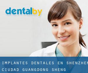 Implantes Dentales en Shenzhen (Ciudad) (Guangdong Sheng)